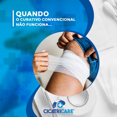 Quando o curativo convencional não funciona